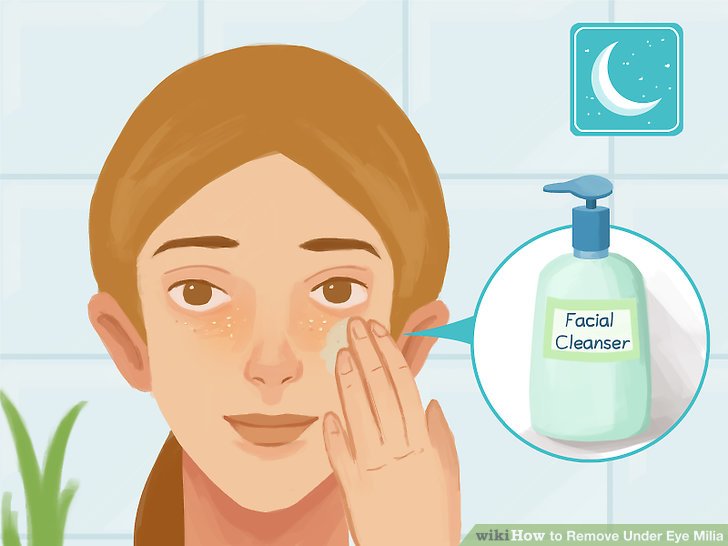 How to Remove Under Eye Milia